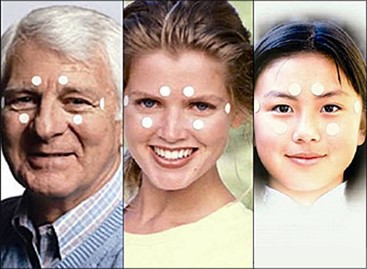 穴位眼贴 圖片 4